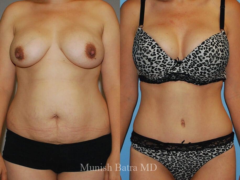 Before and After Image
