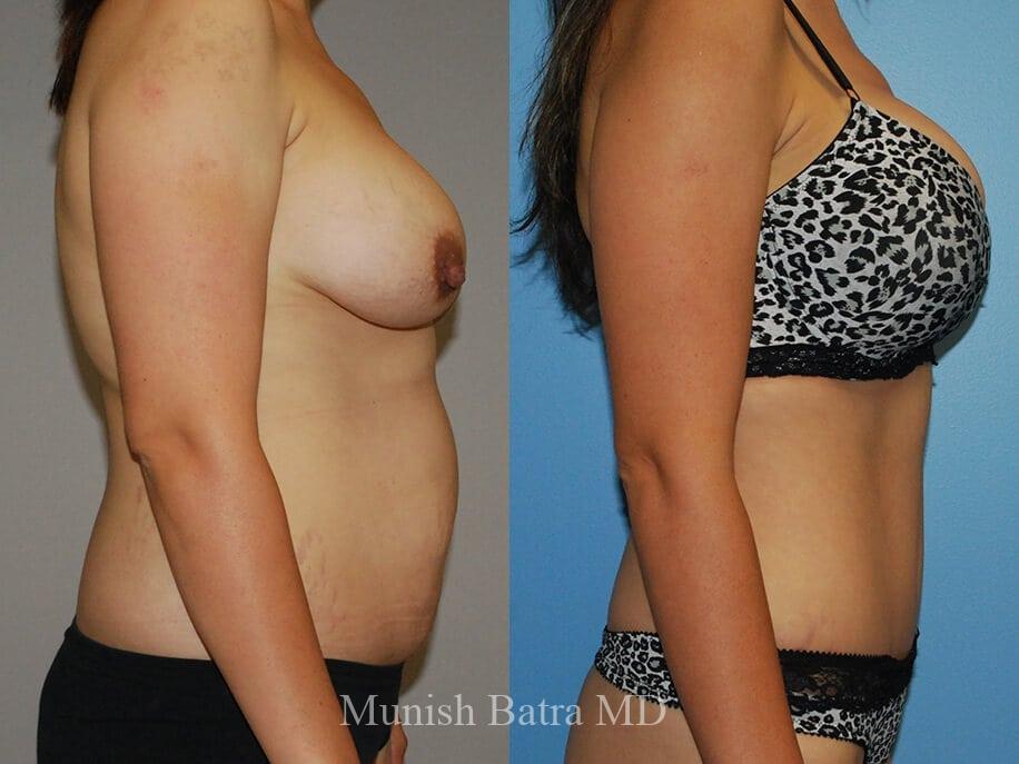 Before and After Image