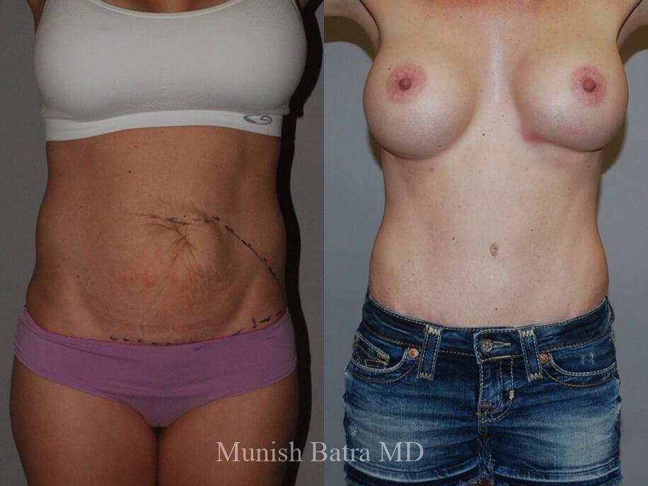 Before and After Image