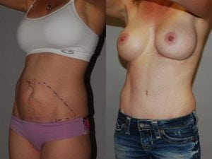 Before and After Image