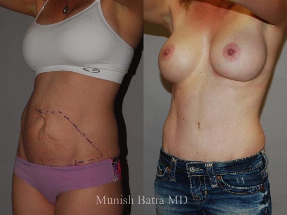Before and After Image