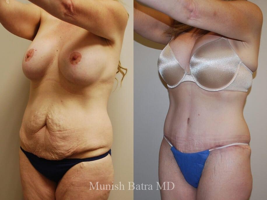 Before and After Image