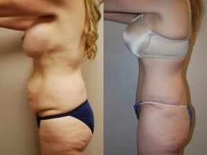 Before and After Image