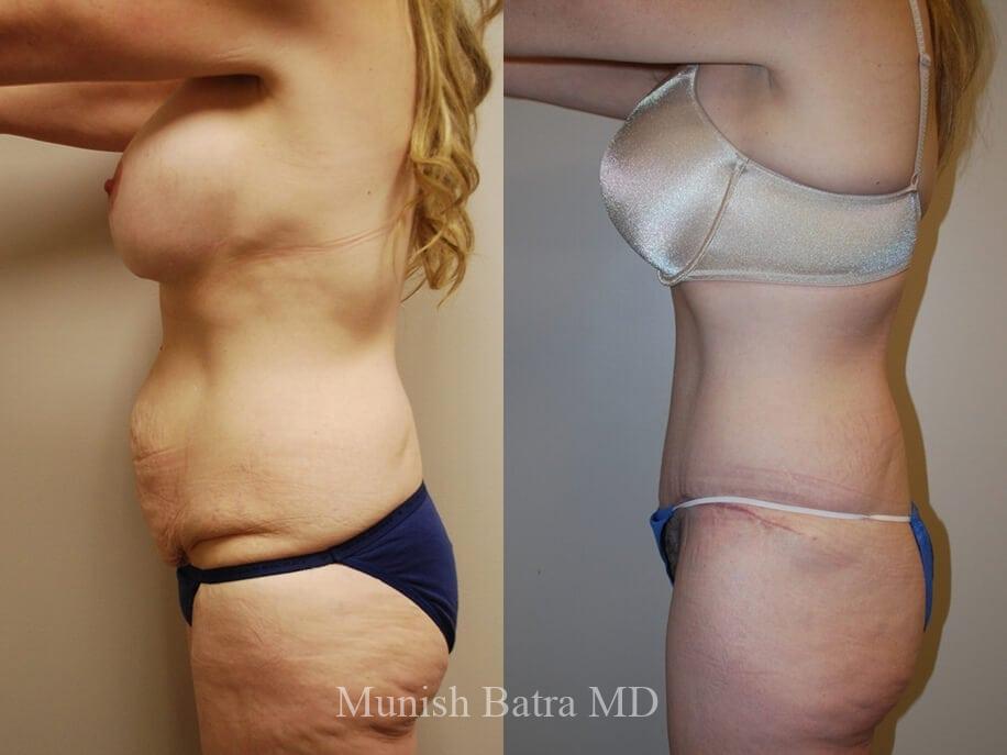 Before and After Image