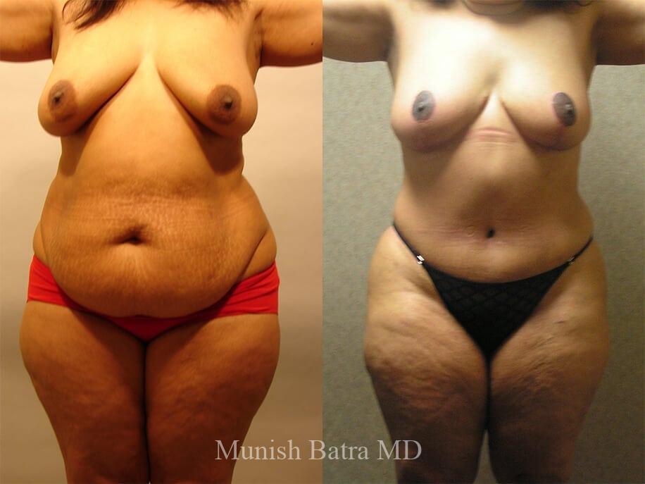 Before and After Image