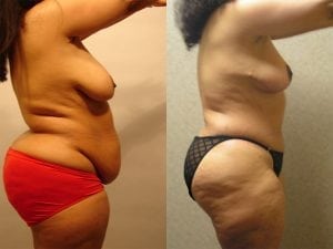 Before and After Image