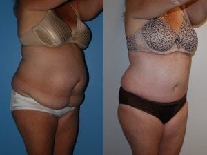 Before and After Image