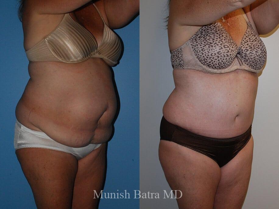 Before and After Image