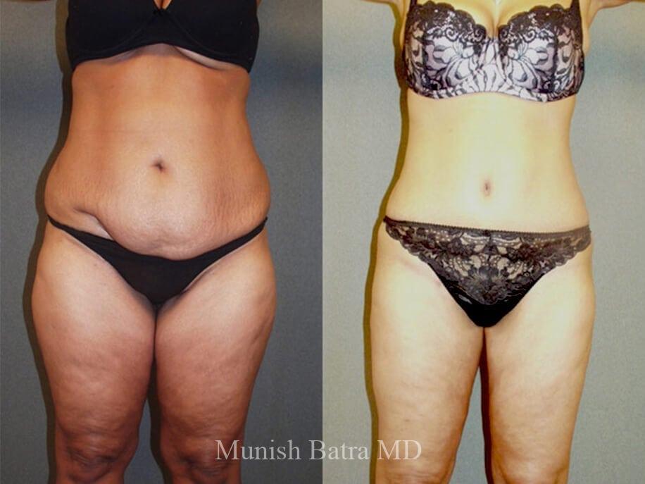 Before and After Image