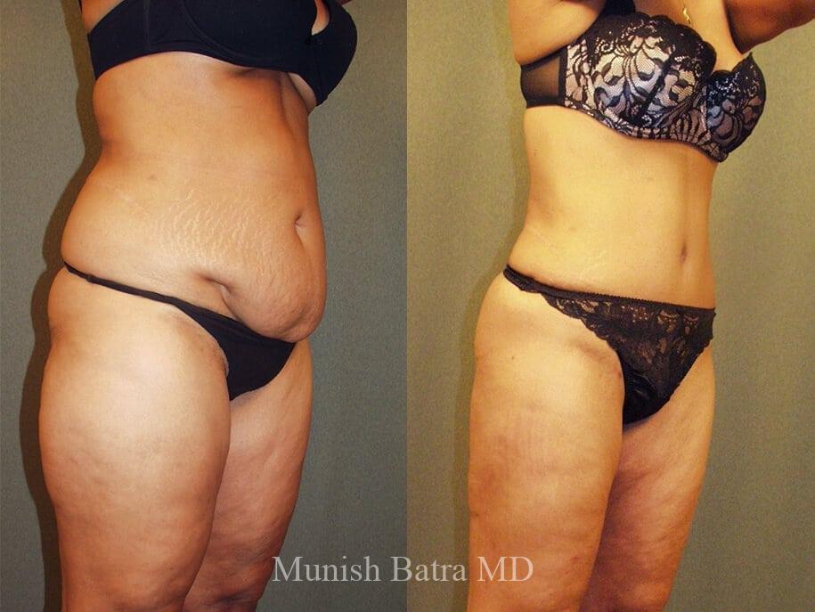 Before and After Image