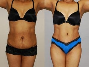 Before and After Image