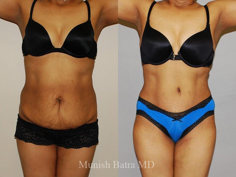 Before and After Image