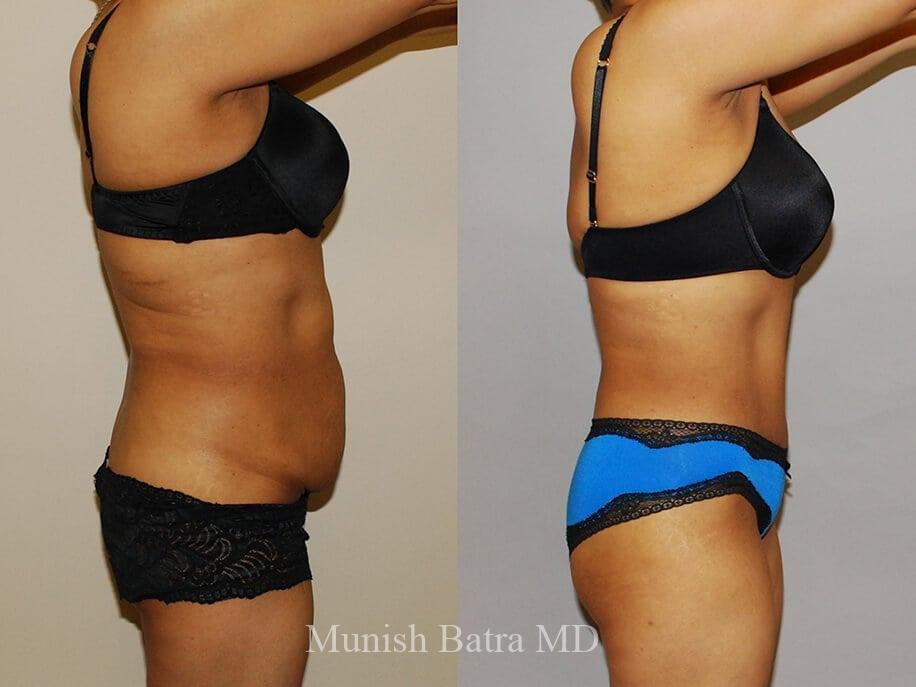 Before and After Image