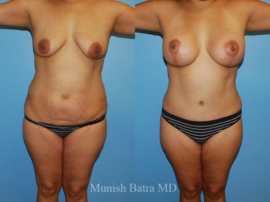 Before and After Image