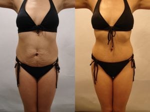 Before and After Image