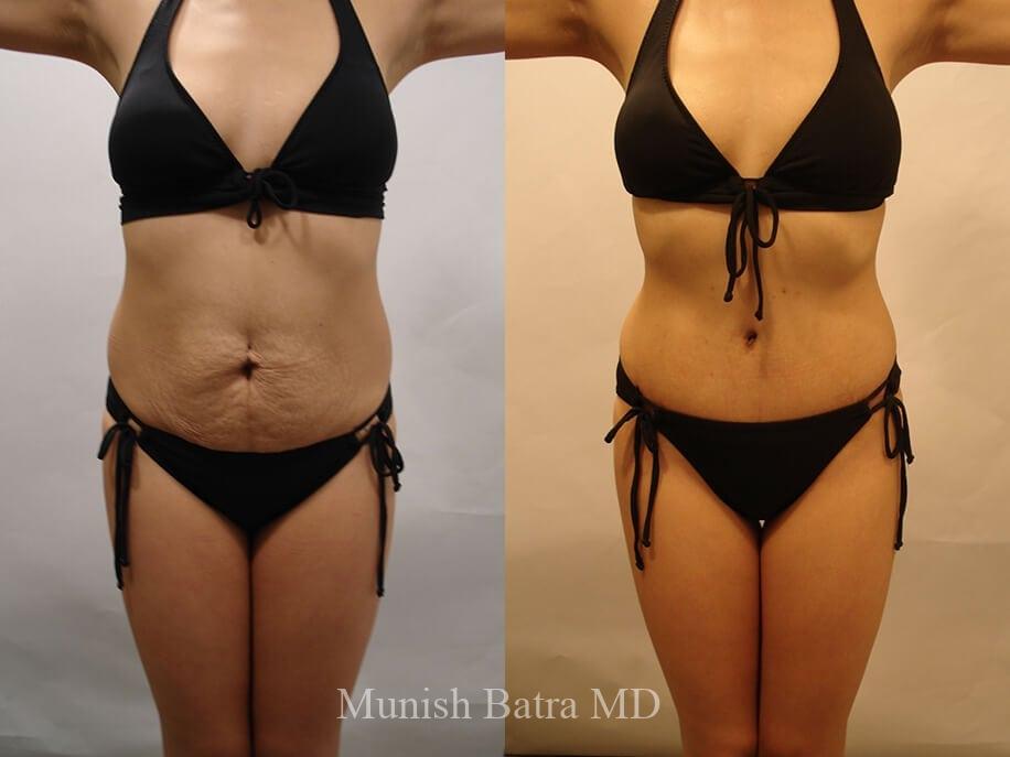 Before and After Image