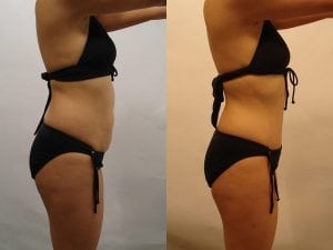 Before and After Image