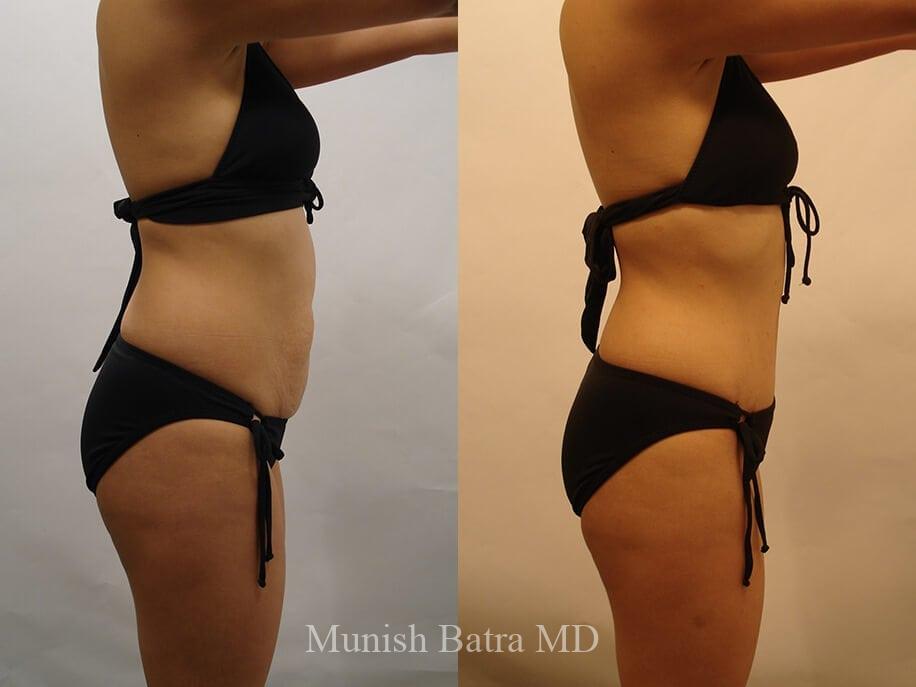 Before and After Image