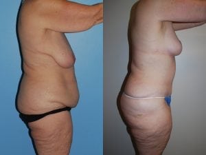 Before and After Image