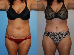 Before and After Image