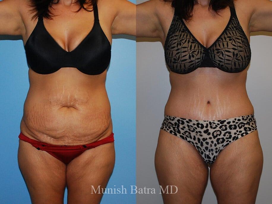 Before and After Image