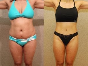 Before and After Image