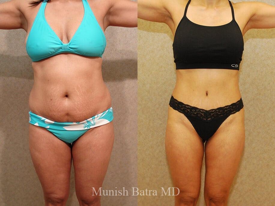 Before and After Image