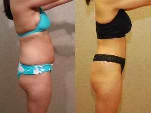 Before and After Image
