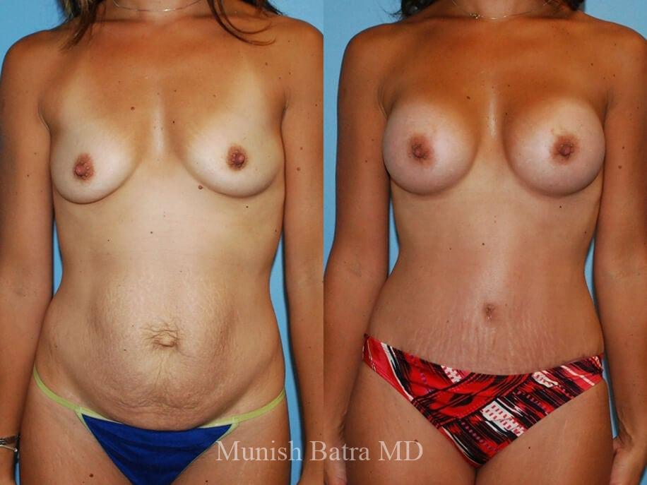Before and After Image