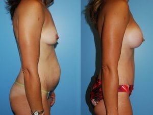 Before and After Image