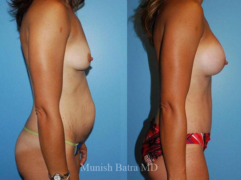 Before and After Image