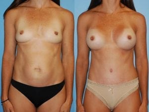 Before and After Image