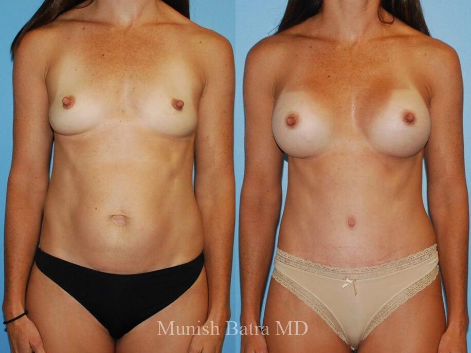 Before and After Image