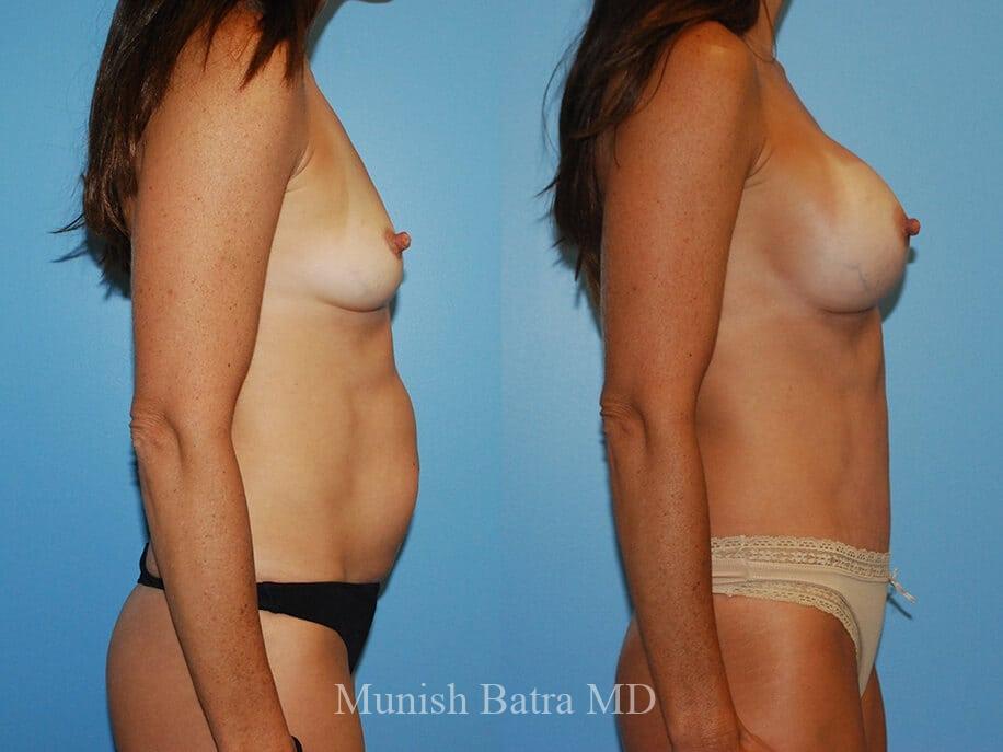 Before and After Image