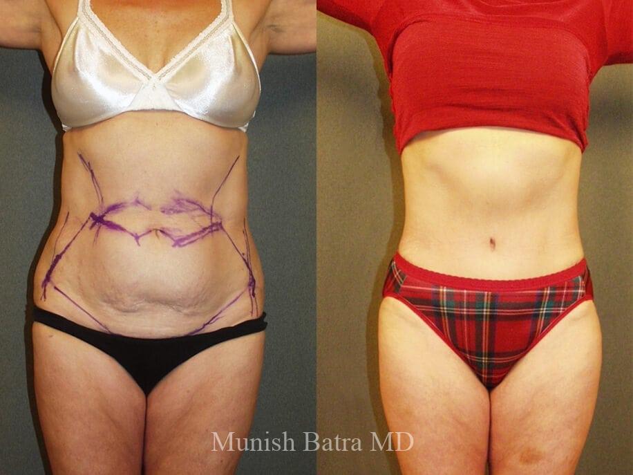 Before and After Image