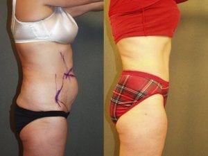 Before and After Image