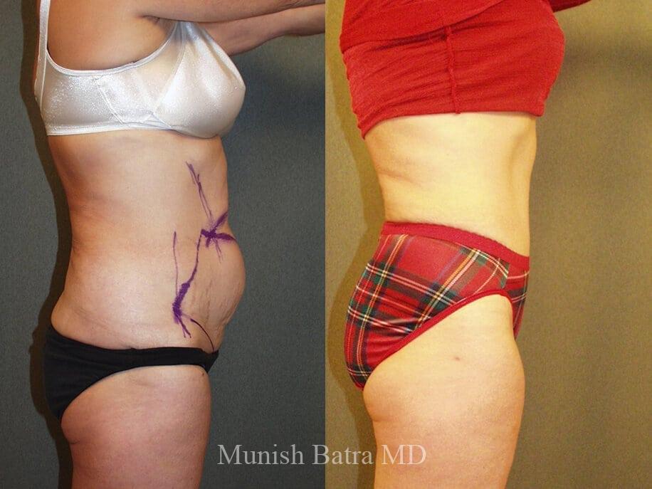 Before and After Image