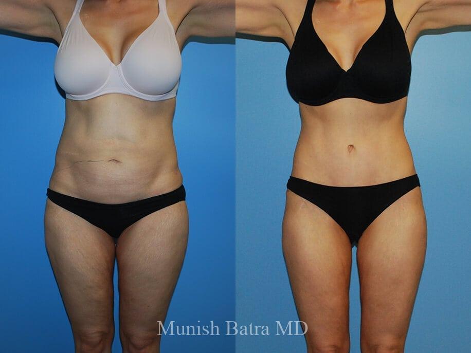 Before and After Image