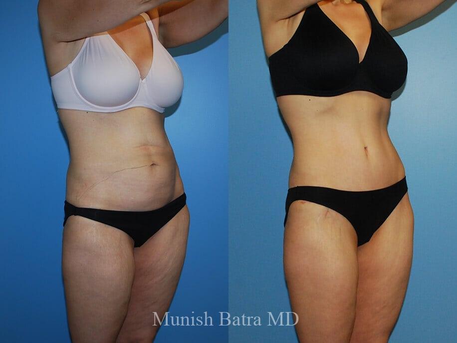 Before and After Image