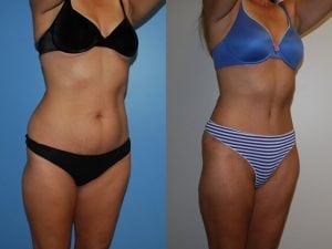 Before and After Image