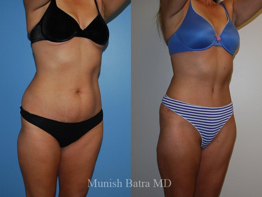 Before and After Image