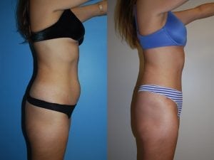 Before and After Image