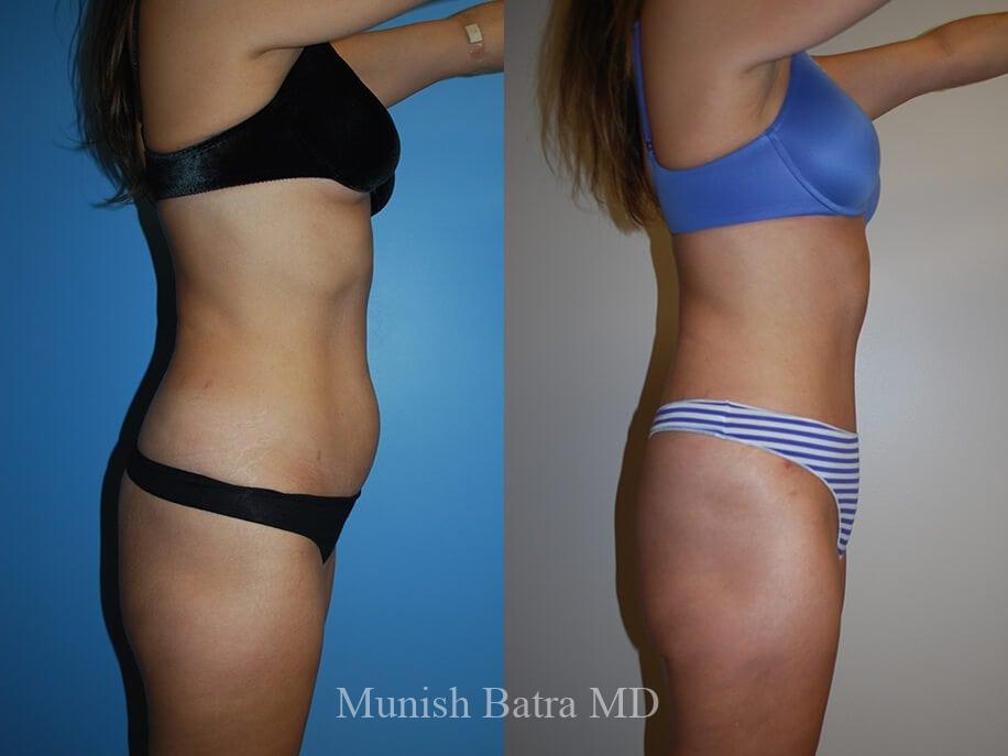 Before and After Image