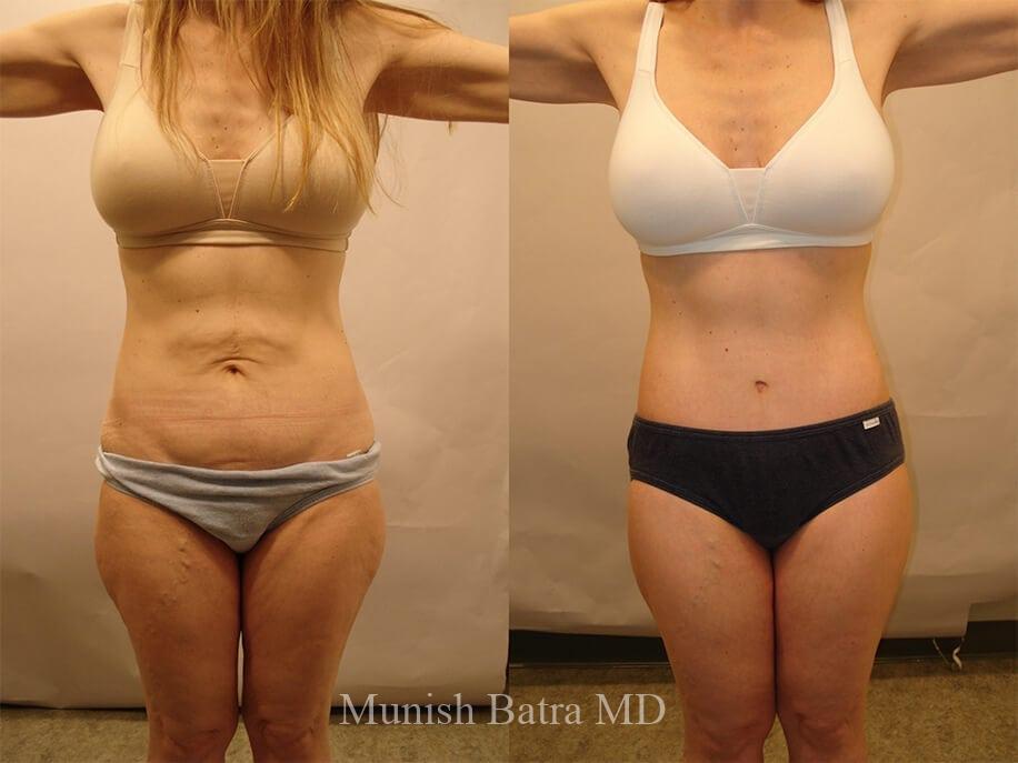 Before and After Image