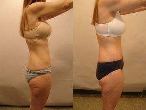 Before and After Image