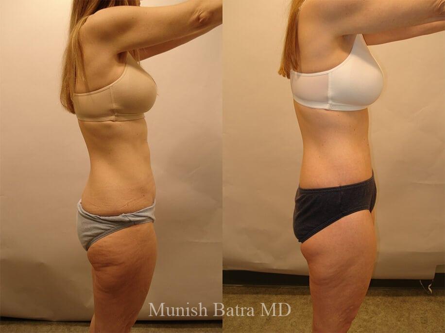 Before and After Image